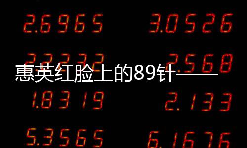 惠英红脸上的89针——她的故事让人感动