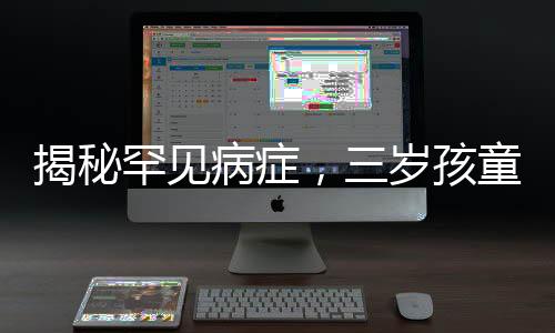 揭秘罕见病症，三岁孩童全身离奇起皮脱衣事件引发关注